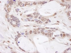 CHAMP1 Rabbit anti-Human, Mouse, Polyclonal, Bethyl Laboratories 100 &mu;L;