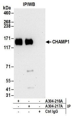 CHAMP1 Rabbit anti-Human, Mouse, Polyclonal, Bethyl Laboratories 100 &mu;L;