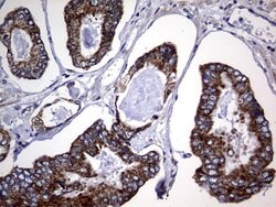 CHCHD3 Monoclonal Antibody (OTI3E10), TrueMAB , OriGene 100 &mu;L; Unconjugated:Antibodies,