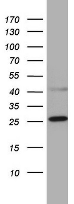 CHCHD3 Mouse anti-Human, Clone: OTI7G4, TrueMAB , Origene 30 &mu;L; Unconjugated:Antibodies,
