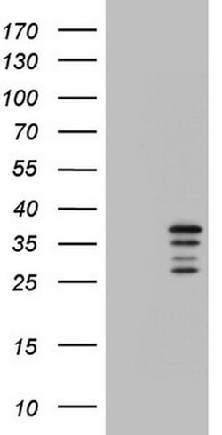 CHCHD3 Monoclonal Antibody (OTI3E10), TrueMAB , OriGene 100 &mu;L; Unconjugated:Antibodies,