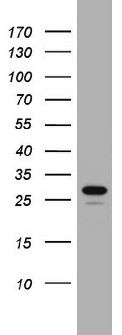 CHCHD3 Monoclonal Antibody (OTI3E10), TrueMAB , OriGene 100 &mu;L; Unconjugated:Antibodies,