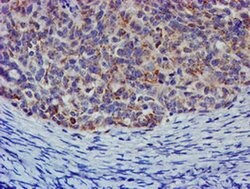 CHCHD5 Monoclonal Antibody (OTI6G6), TrueMAB , OriGene 100 &mu;L; Unconjugated:Antibodies,