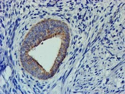 CHCHD5 Monoclonal Antibody (OTI6G6), TrueMAB , OriGene 100 &mu;L; Unconjugated:Antibodies,
