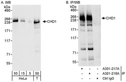 CHD1 Rabbit anti-Human, Polyclonal, Bethyl Laboratories 100 &mu;L; Unconjugated:Antibodies,