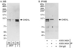 CHD1L Rabbit anti-Human, Polyclonal, Bethyl Laboratories 100 &mu;L | Buy Online | Bethyl Laboratories, Inc | Fisher Scientific