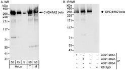 CHD4/Mi2 beta Rabbit anti-Human, Mouse, Polyclonal, Bethyl Laboratories