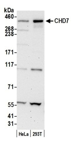 CHD7 Polyclonal Antibody, Bethyl Laboratories 20 &mu;L; Unconjugated:Antibodies,