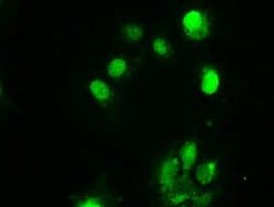 CHEK2 Mouse anti-Canine, Human, Clone: OTI5C4, liquid, TrueMAB 100 &mu;L;