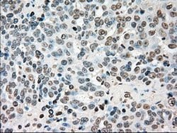 CHEK2 Mouse anti-Canine, Human, Clone: OTI4C10, liquid, TrueMAB 100 &mu;L;