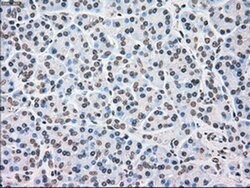CHEK2 Mouse anti-Canine, Human, Clone: OTI4C10, liquid, TrueMAB 100 &mu;L;