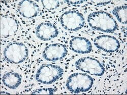 CHEK2 Mouse anti-Canine, Human, Clone: OTI4C10, liquid, TrueMAB 100 &mu;L;