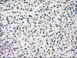 CHEK2 Mouse anti-Canine, Human, Clone: OTI5C4, liquid, TrueMAB 100 &mu;L;