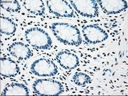 CHEK2 Mouse anti-Canine, Human, Clone: OTI5C4, liquid, TrueMAB 100 &mu;L;