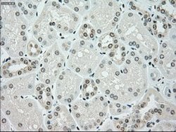 CHEK2 Mouse anti-Canine, Human, Clone: OTI5C4, liquid, TrueMAB 100 &mu;L;