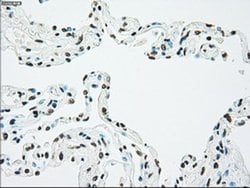 CHEK2 Mouse anti-Canine, Human, Clone: OTI5C4, liquid, TrueMAB 100 &mu;L;