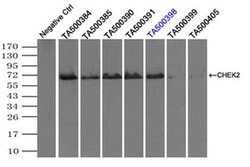 CHEK2 Mouse anti-Canine, Human, Clone: OTI5C4, liquid, TrueMAB 100 &mu;L;