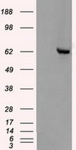 CHEK2 Mouse anti-Canine, Human, Clone: OTI4C10, liquid, TrueMAB 100 &mu;L;