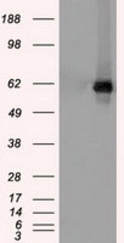 CHEK2 Mouse anti-Canine, Human, Clone: OTI10G7, lyophilized, TrueMAB 100