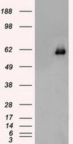 CHEK2 Mouse anti-Canine, Human, Clone: OTI5C4, liquid, TrueMAB 100 &mu;L;