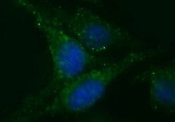 CHGA Monoclonal Antibody (OTI1B7), TrueMAB , OriGene 100 &mu;L; Unconjugated:Antibodies,