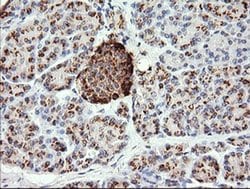 CHGA Monoclonal Antibody (OTI2B11), TrueMAB , OriGene:Antibodies:Primary