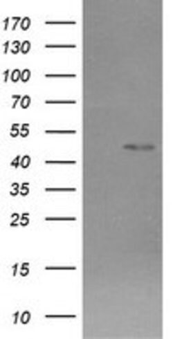 CHGA Mouse anti-Human, Mouse, Clone: OTI2E12, lyophilized, TrueMAB 100