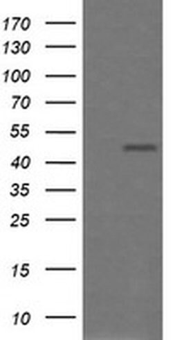 CHGA Monoclonal Antibody (OTI1H2), TrueMAB , OriGene 100 &mu;L; Unconjugated:Antibodies,
