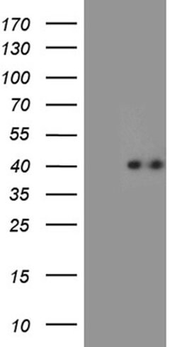 CHIA Mouse anti-Human, Clone: OTI3D8, lyophilized, TrueMAB 100 &mu;g; Unconjugated:Antibodies,