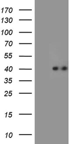 CHIA Monoclonal Antibody (OTI3D8), TrueMAB , OriGene 30 &mu;L; Unconjugated:Antibodies,