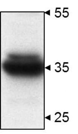 Invitrogen™ STUB1 Polyclonal Antibody