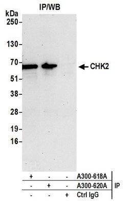 Chk2 Rabbit anti-Human, Polyclonal, Bethyl Laboratories 100 &mu;l; Unlabeled:Antibodies,