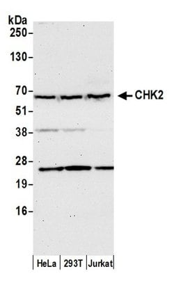 Chk2 Rabbit anti-Human, Polyclonal, Bethyl Laboratories 100 &mu;l; Unlabeled:Antibodies,