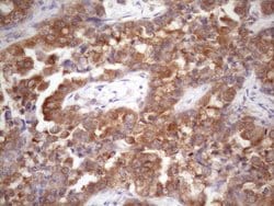 CHMP5 Monoclonal Antibody (OTI5F12), TrueMAB , OriGene 100 &mu;L; Unconjugated:Antibodies,