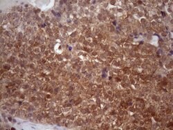 CHMP5 Monoclonal Antibody (OTI5F12), TrueMAB , OriGene 100 &mu;L; Unconjugated:Antibodies,