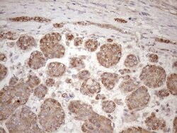 CHMP5 Monoclonal Antibody (OTI2E6), TrueMAB , OriGene 30 &mu;L; Unconjugated:Antibodies,