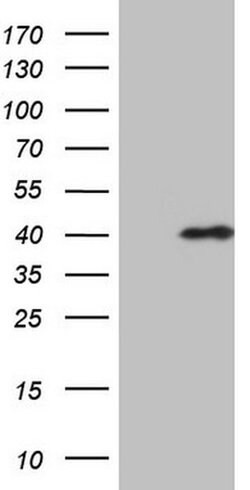 CHMP5 Mouse anti-Human, Clone: OTI5C7, liquid, TrueMAB 100 &mu;L; Unconjugated:Antibodies,
