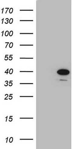 CHMP5 Monoclonal Antibody (OTI5F12), TrueMAB , OriGene 100 &mu;L; Unconjugated:Antibodies,
