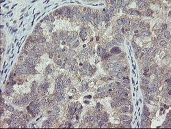 CHN1 Mouse anti-Human, Clone: OTI1C9, lyophilized, TrueMAB 100 &mu;g; Unconjugated:Antibodies,