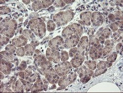 CHN1 Mouse anti-Human, Clone: OTI1C9, lyophilized, TrueMAB 100 &mu;g; Unconjugated:Antibodies,