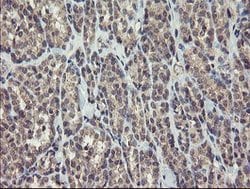 CHN1 Mouse anti-Human, Clone: OTI1C9, lyophilized, TrueMAB 100 &mu;g; Unconjugated:Antibodies,