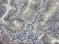 CHN1 Mouse anti-Human, Clone: OTI1C9, lyophilized, TrueMAB 100 &mu;g; Unconjugated:Antibodies,