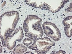 CHN1 Mouse anti-Human, Clone: OTI1C9, lyophilized, TrueMAB 100 &mu;g; Unconjugated:Antibodies,