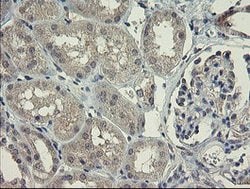 CHN1 Mouse anti-Human, Clone: OTI1C9, lyophilized, TrueMAB 100 &mu;g; Unconjugated:Antibodies,
