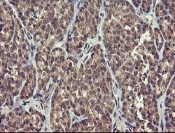 CHN1 Mouse anti-Human, Clone: OTI1B7, lyophilized, TrueMAB 100 &mu;g; Unconjugated:Antibodies,