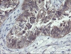 CHN1 Monoclonal Antibody (OTI2D10), TrueMAB , OriGene 30 &mu;L; Unconjugated:Antibodies,