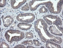 CHN1 Monoclonal Antibody (OTI2D10), TrueMAB , OriGene 30 &mu;L; Unconjugated:Antibodies,