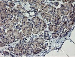 CHN1 Monoclonal Antibody (OTI3C6), TrueMAB , OriGene 30 &mu;L; Unconjugated:Antibodies,