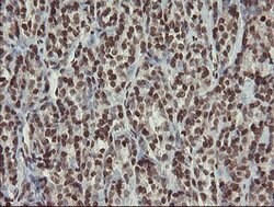 CHN1 Mouse anti-Human, Clone: OTI2G6, lyophilized, TrueMAB 100 &mu;g; Unconjugated:Antibodies,