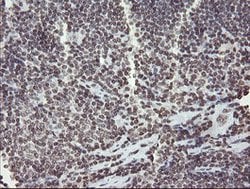 CHN1 Mouse anti-Human, Clone: OTI2G6, lyophilized, TrueMAB 100 &mu;g; Unconjugated:Antibodies,